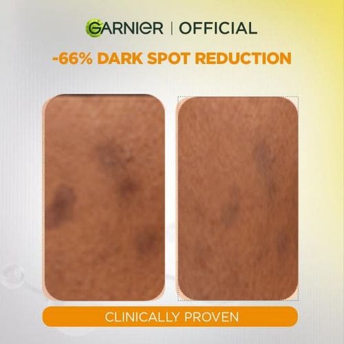 Garnier Even & Bright Vitamin C Booster Serum - (30ml)
