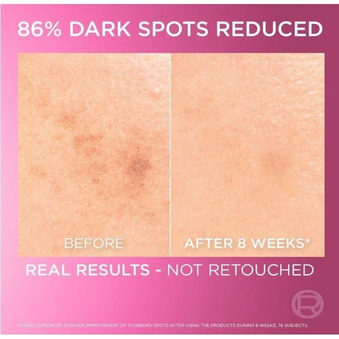 L’oreal Paris Glycolic Bright Instant Glowing Serum - (30ML)